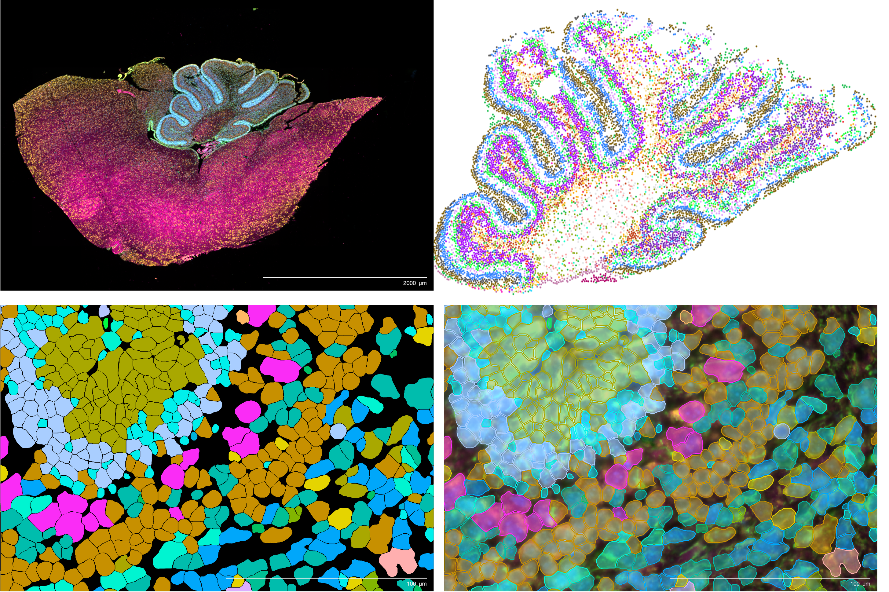 マウス Xenium 5K データ