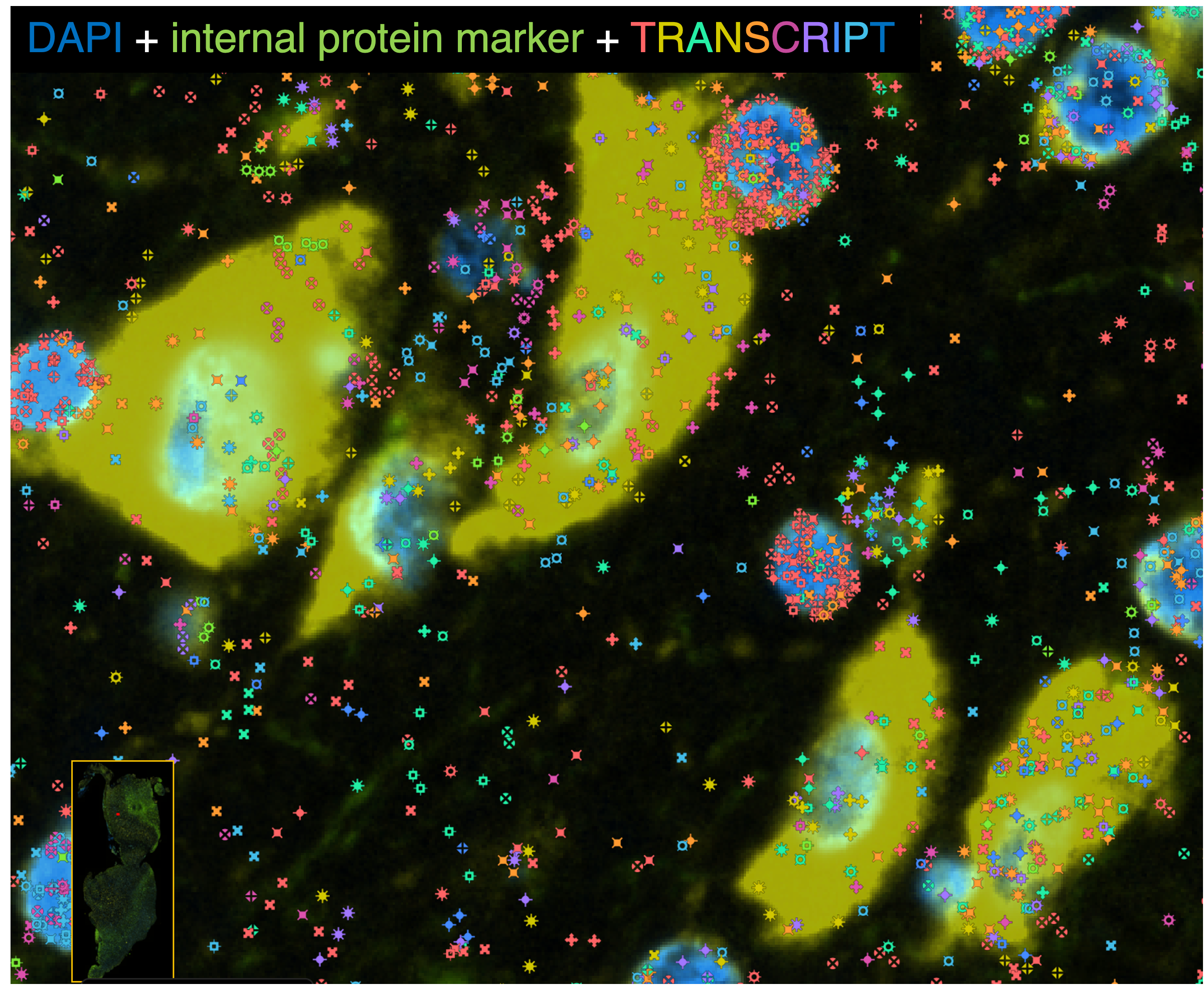 mTORopathy データ
